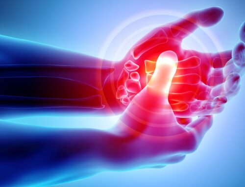 Carpal Tunnel Syndrome Relief